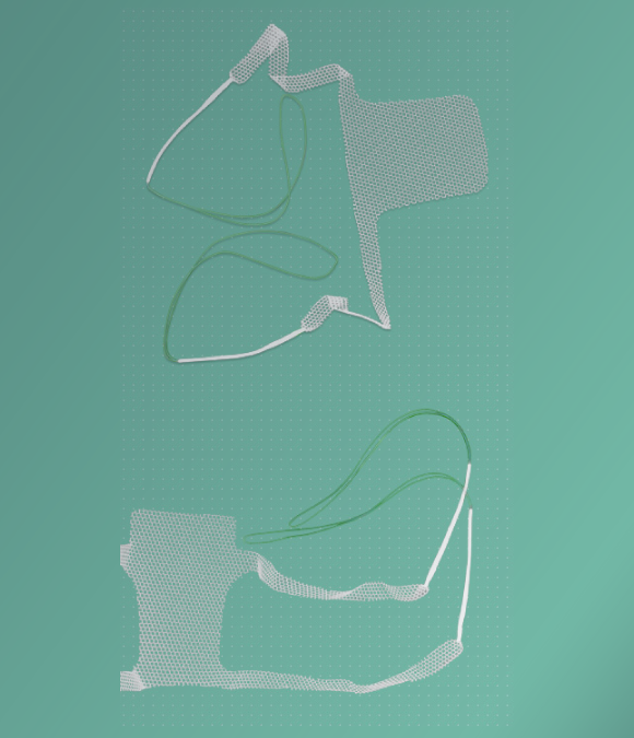 Implants SAFIRE